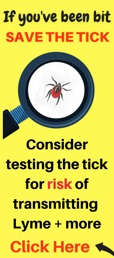 Link to lab that will test a tick for risk of carrying and transmitting lyme disease and coinfections
